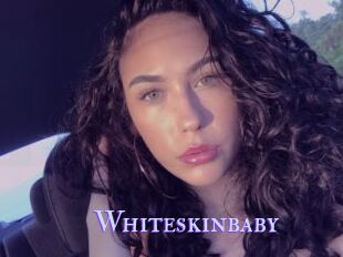 Whiteskinbaby